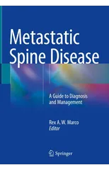 Metastatic Spine Disease