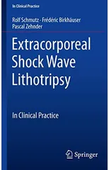 Extracorporeal Shock Wave Lithotripsy