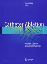 Catheter Ablation