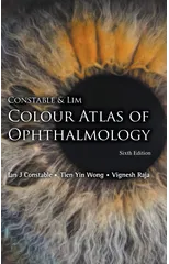 Constable & Lim Colour Atlas Of Ophthalmology (Sixth Edition)
