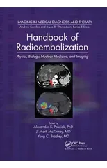 Handbook of Radioembolization