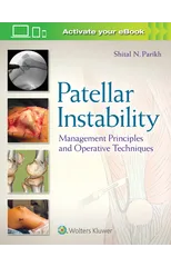 Patellar Instability