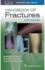 Handbook of Fractures