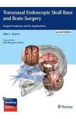 Transnasal Endoscopic Skull Base and Brain Surgery