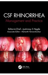 CSF Rhinorrhoea