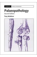 Palaeopathology