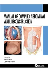 Manual of Complex Abdominal Wall Reconstruction