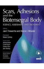 Scars, Adhesions and the Biotensegral Body