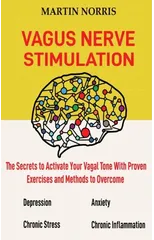 Vagus Nerve Stimulation