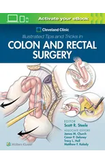 Cleveland Clinic Illustrated Tips and Tricks in Colon and Rectal Surgery
