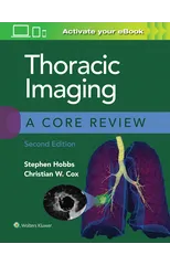 Thoracic Imaging