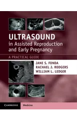 Ultrasound in Assisted Reproduction and Early Pregnancy