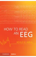 How to Read an EEG