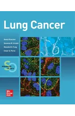 Lung Cancer