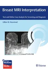 Breast MRI Interpretation