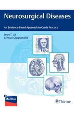 Neurosurgical Diseases