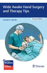 Wide Awake Hand Surgery and Therapy Tips
