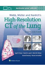 Webb, Muller and Naidich's High-Resolution CT of the Lung