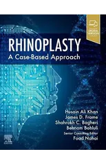 Rhinoplasty