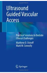 Ultrasound Guided Vascular Access