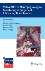 Video Atlas of Neurophysiological Monitoring in Surgery of Infiltrating Brain Tumors