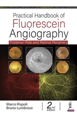 Practical Handbook of Fluorescein Angiography