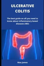 ULCERATIVE COLITIS