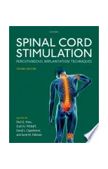 Spinal Cord Stimulation