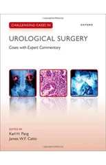 Challenging Cases in Urological Surgery