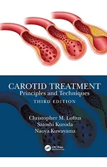 Carotid Treatment
