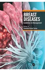 Breast Diseases