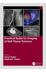 Practical Guide for Imaging of Soft Tissue Tumours