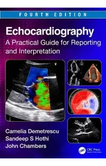 Echocardiography