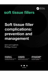 Soft Tissue Filler Complications