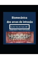 Biomecanica dos Arcos de Intrusao