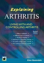An Emerald Guide To Explaining Arthritis