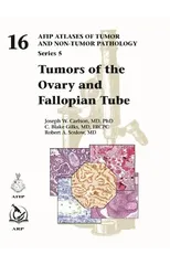 Tumors of the Ovary and Fallopian Tube