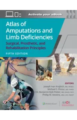 Atlas of Amputations and Limb Deficiencies 5