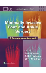 Minimally Invasive Foot and Ankle Surgery