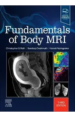 Fundamentals of Body MRI