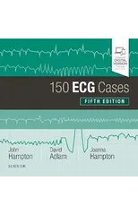 160 ECG Cases