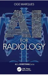 AI for Radiology