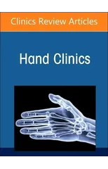 Advances in Microsurgical Reconstruction in the Upper Extremity, An Issue of Hand Clinics