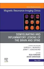 Demyelinating and Inflammatory Lesions of the Brain and Spine, An Issue of Magnetic Resonance Imaging Clinics of North America