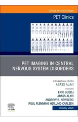 PET Imaging in Central Nervous System Disorders, An Issue of PET Clinics