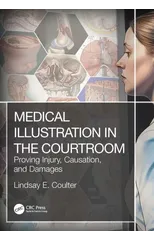 Medical Illustration in the Courtroom