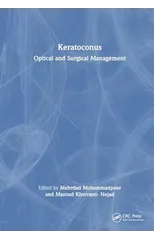Keratoconus