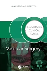 Vascular Surgery