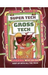 Super Tech