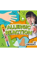 Allergic Reaction